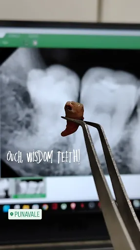 Dental World Dental clinic in Punawale